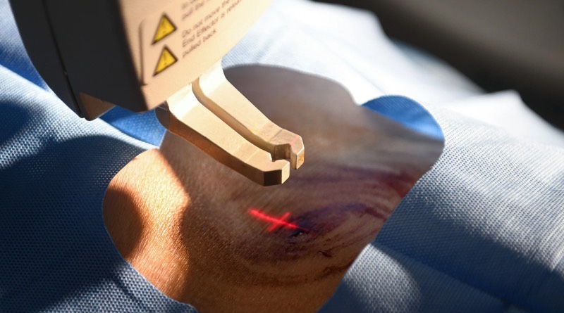 can-canh-sinh-thiet-bang-robot-ai-choc-kim-vao-tuy-song-benh-nhan-o-tphcm-robot-moi