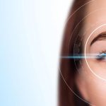 phakic-customeyes-la-gi-thumb